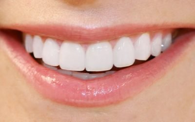 Teeth Whitening – Giving you a Brighter, Whiter Smile!