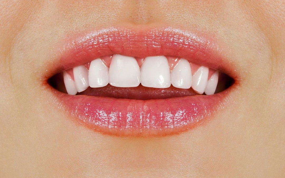 Passion Family Dentist Tips: 6 Effective Ways To Get Healthy, White Teeth