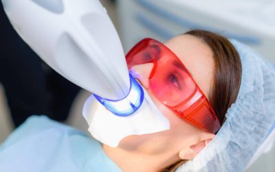 Professional Teeth Whitening vs Over-the-Counter Whitening