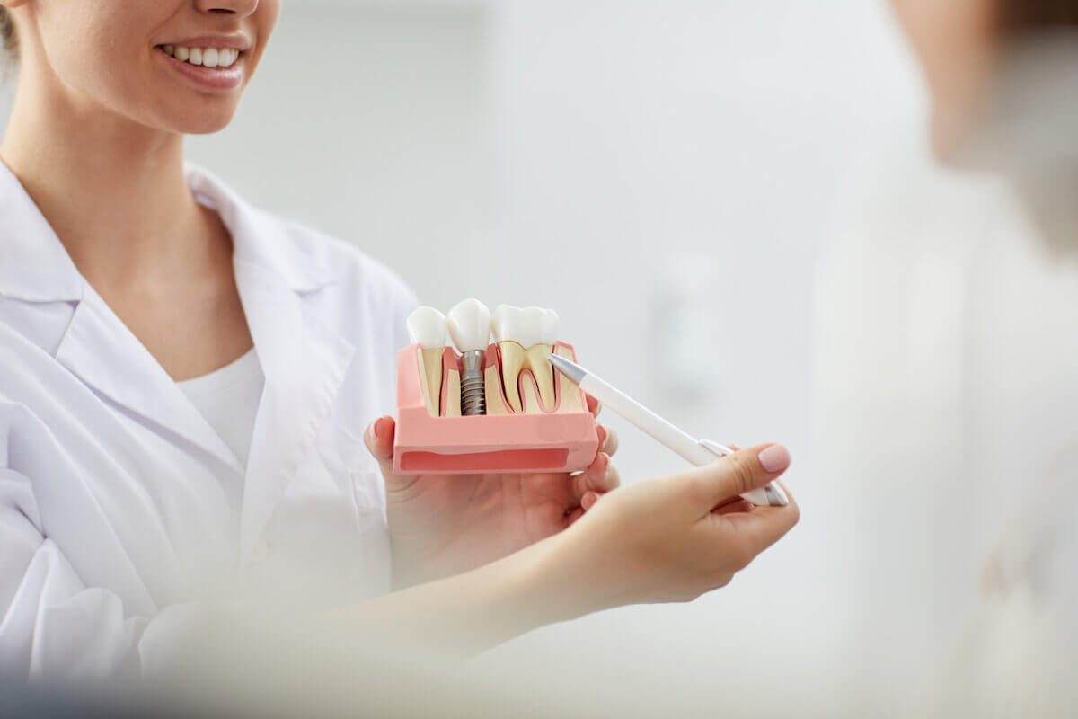 top 6 reasons why dental implants are the best option for replacing missing teeth